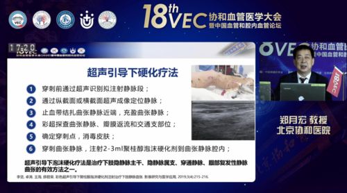 聚桂醇微創(chuàng)硬化治療技術(shù)學(xué)術(shù)推廣會(huì)六會(huì)同開(kāi)，軟件助力數(shù)字化診療